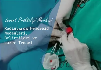 Kadınlarda Hemoroid Nedenleri Belirtileri ve Lazer Tedavi