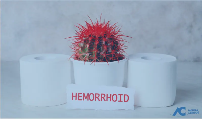 Hemoroid Tedavi