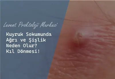 kıl dönmesi tedavisi