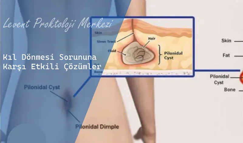 Kıl Dönmesi Sorununa Karşı Etkili Çözümler
