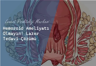 hemoroid ameliyatı