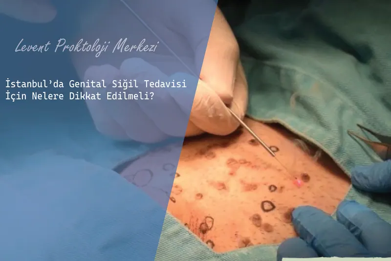 İstanbul’da Genital Siğil Tedavisi İçin Nelere Dikkat Edilmeli