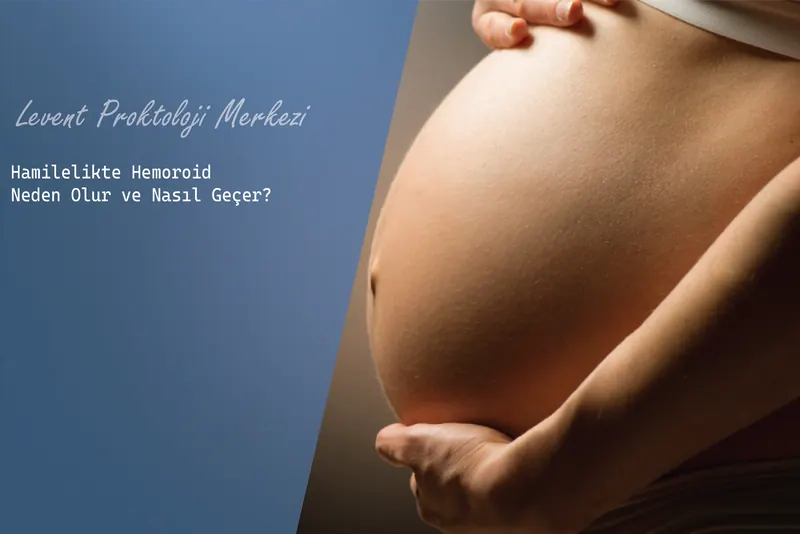 Hamilelikte Hemoroid Neden Olur ve Nasıl Geçer?