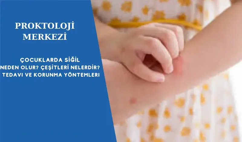 Çocuklarda Siğil Neden Olur Çeşitleri Nelerdir Tedavi ve Korunma Yöntemleri